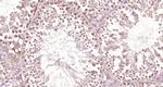 Phospho-DNA PK/PRKDC (Thr2609) Antibody in Immunohistochemistry (Paraffin) (IHC (P))