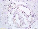 Phospho-PPAR Gamma (Ser112) Antibody in Immunohistochemistry (Paraffin) (IHC (P))