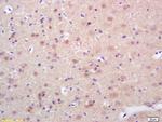 Phospho-HSF1 (Ser326) Antibody in Immunohistochemistry (Paraffin) (IHC (P))