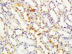 S100A4 Antibody in Immunohistochemistry (Paraffin) (IHC (P))