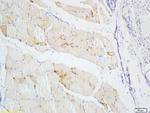 S100A4 Antibody in Immunohistochemistry (Paraffin) (IHC (P))