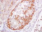 S100A4 Antibody in Immunohistochemistry (Paraffin) (IHC (P))