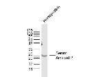 SAP/Serum Amyloid P Antibody in Western Blot (WB)