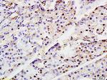 ASF1A Antibody in Immunohistochemistry (Paraffin) (IHC (P))