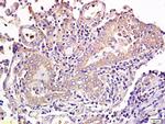 CD1a/Cortical thymocyte antigen CD1A Antibody in Immunohistochemistry (Paraffin) (IHC (P))
