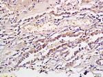 CD1a/Cortical thymocyte antigen CD1A Antibody in Immunohistochemistry (Paraffin) (IHC (P))