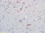 SCD1 Antibody in Immunohistochemistry (Paraffin) (IHC (P))