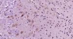 SCD1 Antibody in Immunohistochemistry (Paraffin) (IHC (P))