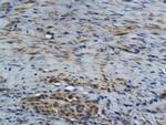 GM-CSF Antibody in Immunohistochemistry (Paraffin) (IHC (P))