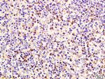 CD75 Antibody in Immunohistochemistry (Paraffin) (IHC (P))