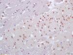 CRX1 Antibody in Immunohistochemistry (Paraffin) (IHC (P))