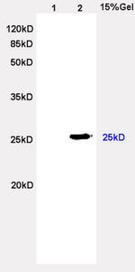 Lambda Light Chain Antibody in Western Blot (WB)