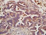 MSH6 Antibody in Immunohistochemistry (Paraffin) (IHC (P))