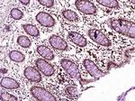 MSH6 Antibody in Immunohistochemistry (Paraffin) (IHC (P))