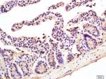 Villin Antibody in Immunohistochemistry (Paraffin) (IHC (P))