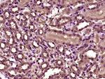 Villin Antibody in Immunohistochemistry (Paraffin) (IHC (P))