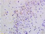 Oct-4BOCT4B-190NT Antibody in Immunohistochemistry (Paraffin) (IHC (P))