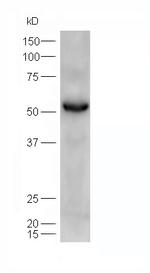 ATGL/Adipose Triglyceride Lipase Antibody in Western Blot (WB)