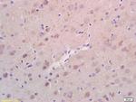 RHEB Antibody in Immunohistochemistry (Paraffin) (IHC (P))