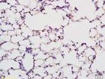 PABP Antibody in Immunohistochemistry (Paraffin) (IHC (P))