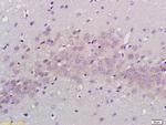 PABP Antibody in Immunohistochemistry (Paraffin) (IHC (P))