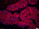 Amphiregulin Antibody in Immunohistochemistry (Paraffin) (IHC (P))