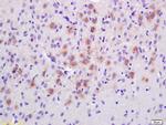 EPS8 Antibody in Immunohistochemistry (Paraffin) (IHC (P))