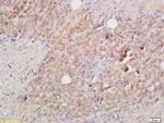 BCMA/CD269 Antibody in Immunohistochemistry (Paraffin) (IHC (P))