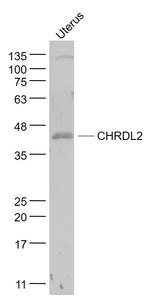 CHRDL2 Antibody in Western Blot (WB)
