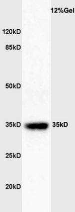 GATA-1 Antibody in Western Blot (WB)