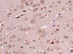 ATG4A Antibody in Immunohistochemistry (Paraffin) (IHC (P))