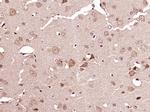 ATG4A Antibody in Immunohistochemistry (Paraffin) (IHC (P))
