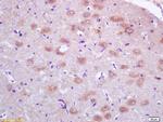 PRDX1 Antibody in Immunohistochemistry (Paraffin) (IHC (P))