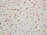 TXNIP Antibody in Immunohistochemistry (Paraffin) (IHC (P))