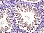 CYP11B1 Antibody in Immunohistochemistry (Paraffin) (IHC (P))