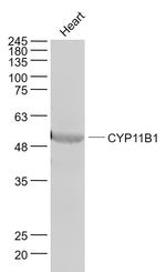 CYP11B1 Antibody in Western Blot (WB)