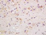 CYP24A1 Antibody in Immunohistochemistry (Paraffin) (IHC (P))