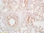 LTA4H Antibody in Immunohistochemistry (Paraffin) (IHC (P))