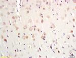 MSH gamma 1 Antibody in Immunohistochemistry (Paraffin) (IHC (P))