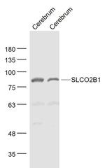 SLCO2B1/OATPB Antibody in Western Blot (WB)