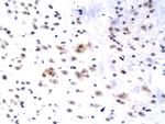 WIF1 Antibody in Immunohistochemistry (Paraffin) (IHC (P))