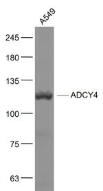 ADCY4 Antibody in Western Blot (WB)