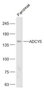 ADCY5 Antibody in Western Blot (WB)