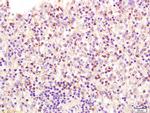 ADCY6 Antibody in Immunohistochemistry (Paraffin) (IHC (P))