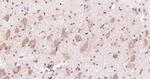 CACNA1A/Cav2.1 Antibody in Immunohistochemistry (Paraffin) (IHC (P))