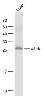 ETFB Antibody in Western Blot (WB)