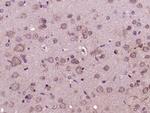 Glucagon Receptor Antibody in Immunohistochemistry (Paraffin) (IHC (P))