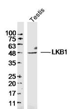 LKB1 Antibody in Western Blot (WB)