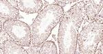 LYK5 Antibody in Immunohistochemistry (Paraffin) (IHC (P))