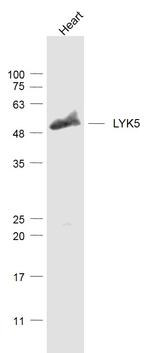 LYK5 Antibody in Western Blot (WB)